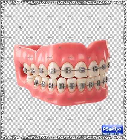 دانلود وکتور ارتودنسی