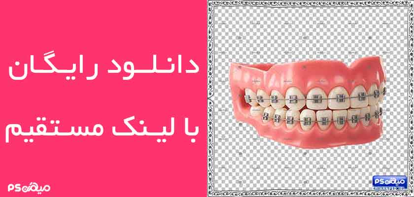 وکتور سه بعدی ارتودنسی